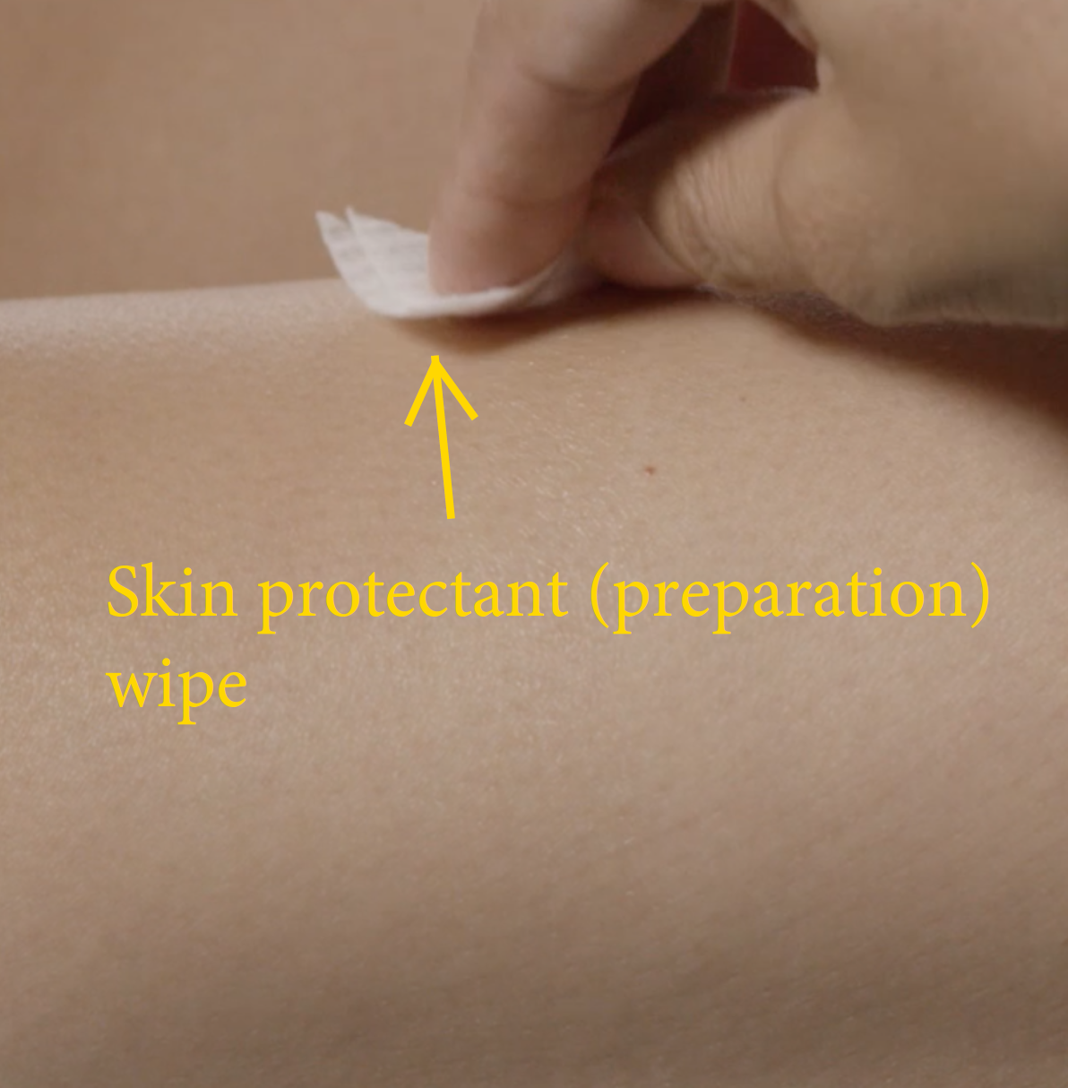 Areza Medical - Bordered Gauze Island Dressing - Wound Dressing - Latex Free - sterile - 6" x 6" - 30 per Box