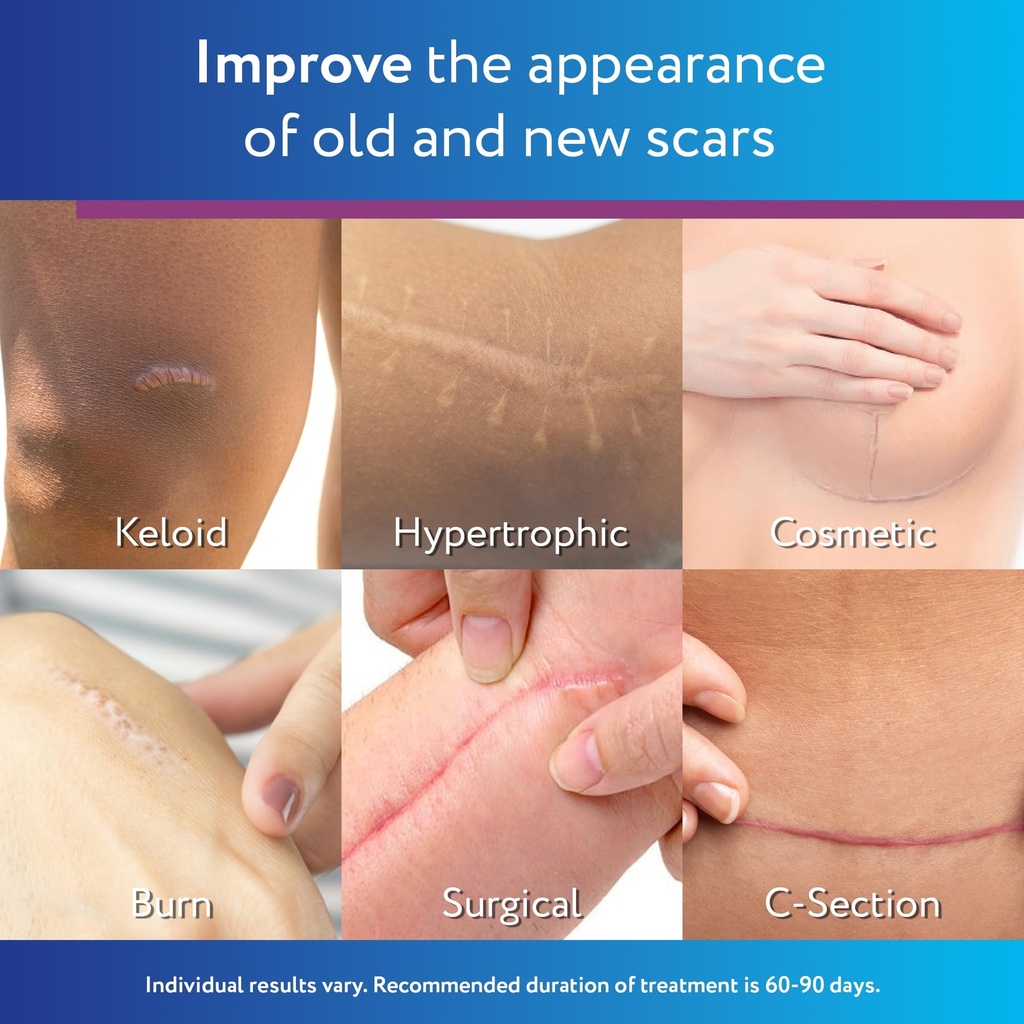 scaraway-silicone-scar-gel-helps-improve-3.jpg