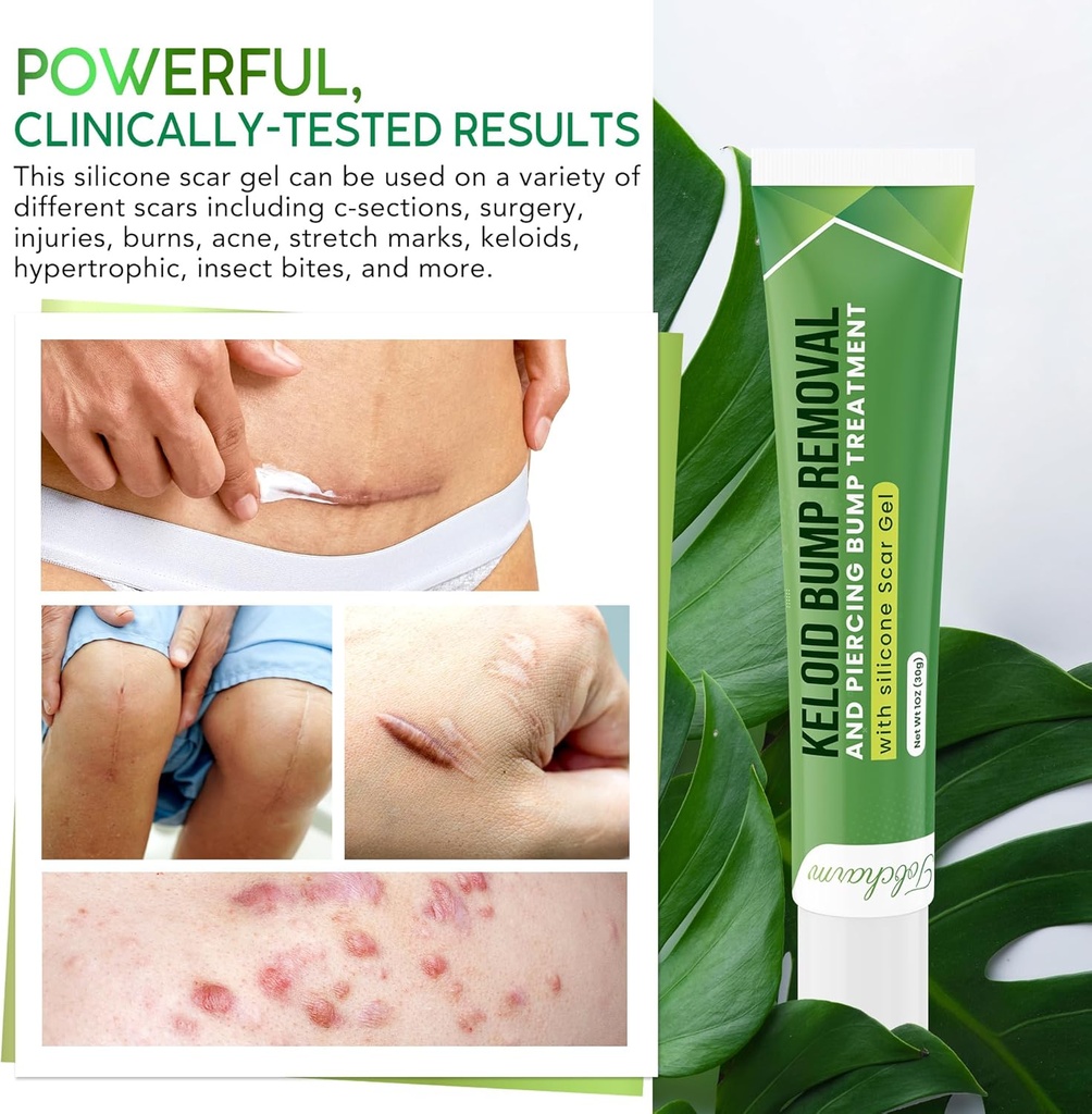 advanced-keloid-bump-removal-gel-silicon-5.jpg