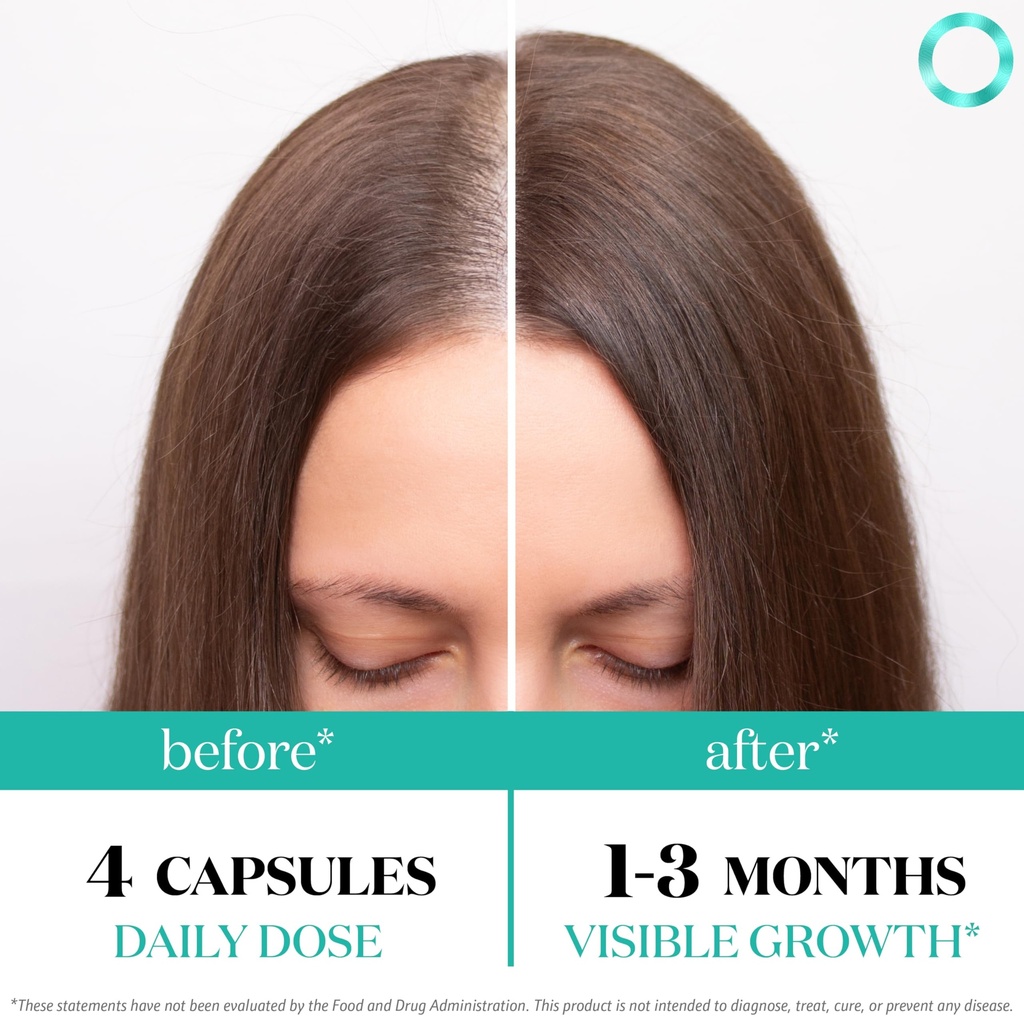 women-s-balance-hair-growth-supplements--3.jpg