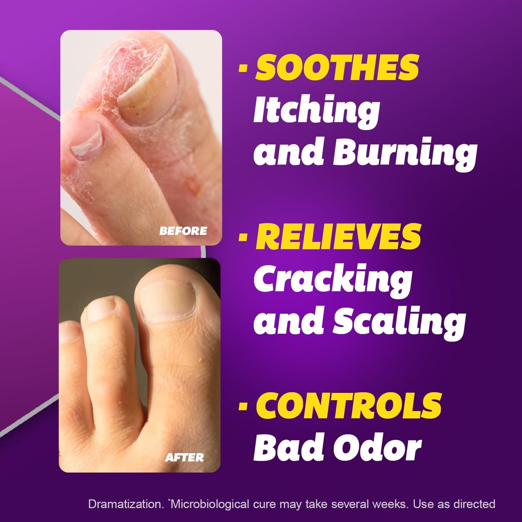 silka-anti-fungal-cream-clinical-anti-fu-3.jpg