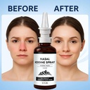 iodine-nasal-spray-nasal-iodine-spray-wi-6.jpg