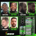 beard-growth-kit-w-6x-liquid-biotin-supp-4.jpg