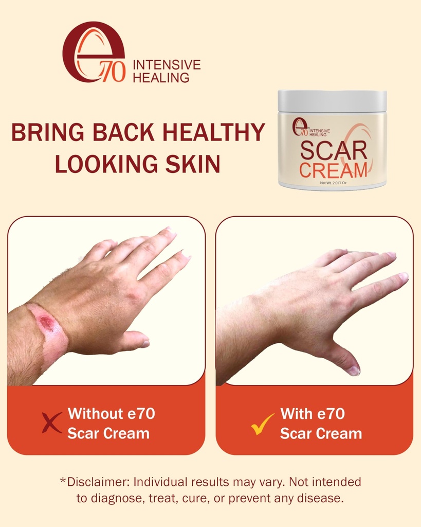 scar-cream-gel-for-surgical-scars-fast-r-5.jpg
