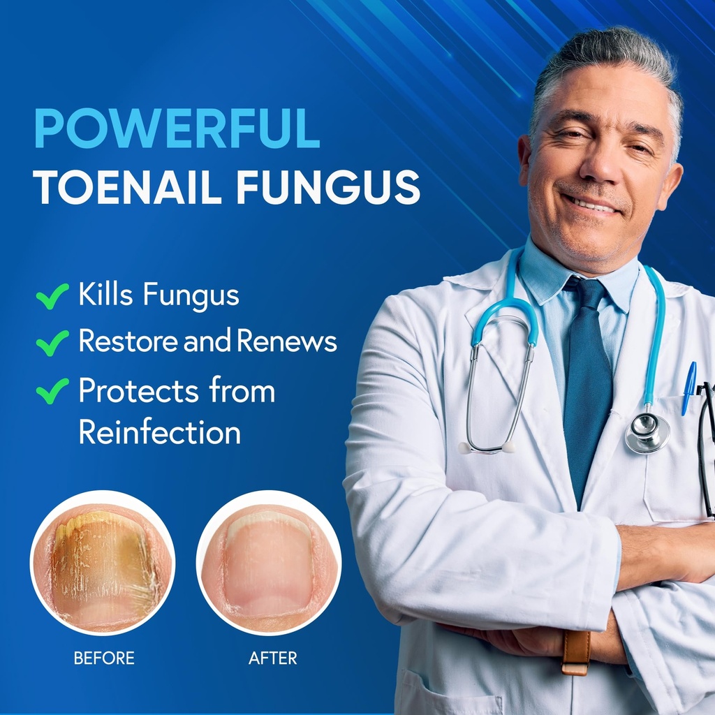 toenail-fungus-treatment-extra-strength--2.jpg