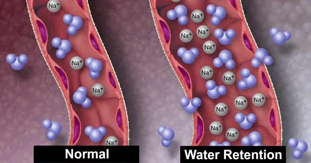 diuretic-water-retention-relief-for-swel-61Pclik5nuL.jpg
