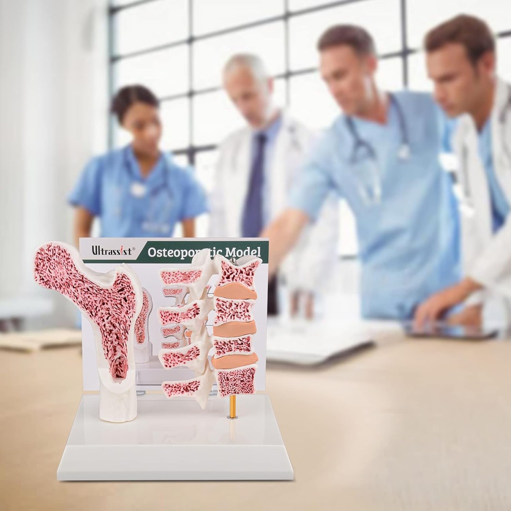 ultrassist-human-anatomy-osteoporosis-mo-5.jpg
