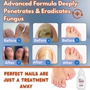 toenail-fungus-treatment-extra-strength--2.jpg