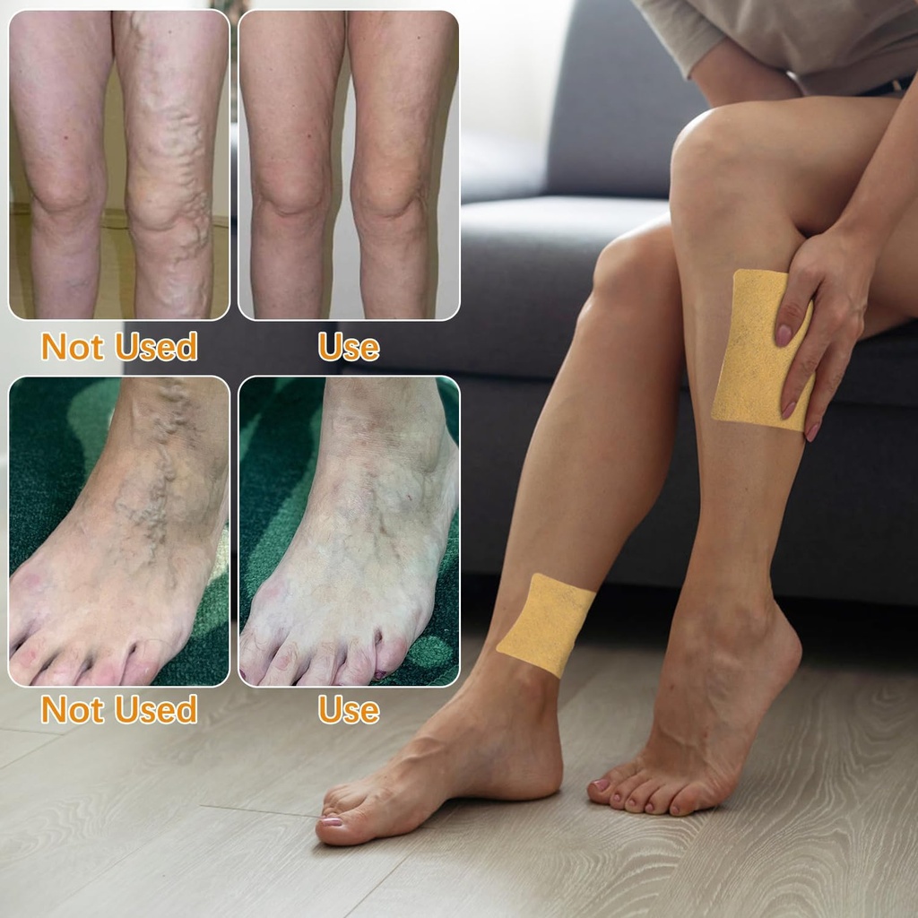 turmeric-varicose-veins-treatment-for-le-2.jpg