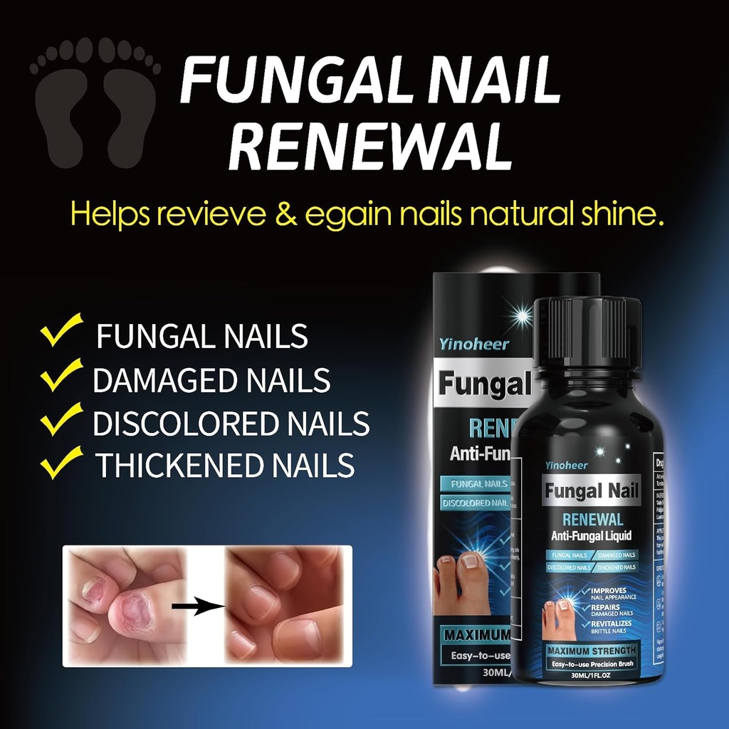 toenail-fungus-treatment-nail-fungus-tre-4.jpg