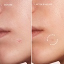 maree-eye-gels-acne-сlearing-devices-bun-3.jpg