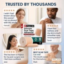 medical-grade-silicone-scar-tape-advance-5.jpg