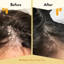 eczema-honey-soothing-scalp-oil---natura-4.jpg
