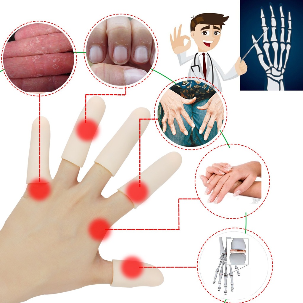 gel-finger-cots-finger-protector-support-2.jpg