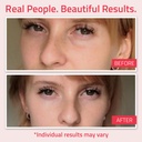 yeouth-retinol-eye-cream-anti-aging-firm-4.jpg
