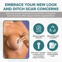 epiderm-areopexy-silicone-scar-sheets-re-2.jpg