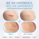 medical-grade-silicone-scar-sheets---7-r-3.jpg