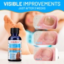 toenail-fungus-treatmenttoe-fungus-nail--6.jpg