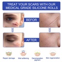 new-transparent-silicone-scar-sheets16-x-4.jpg