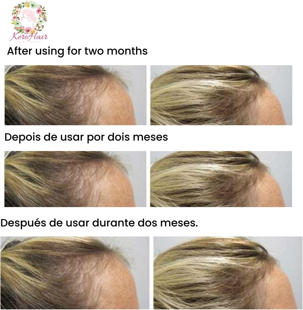 kerohair-complete-supplement-with-vitami-3.jpg