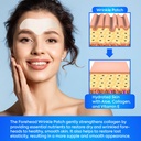 forehead-wrinkle-patches-12pcs-with-aloe-3.jpg