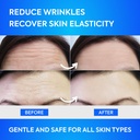 forehead-wrinkle-patches-12pcs-with-aloe-5.jpg