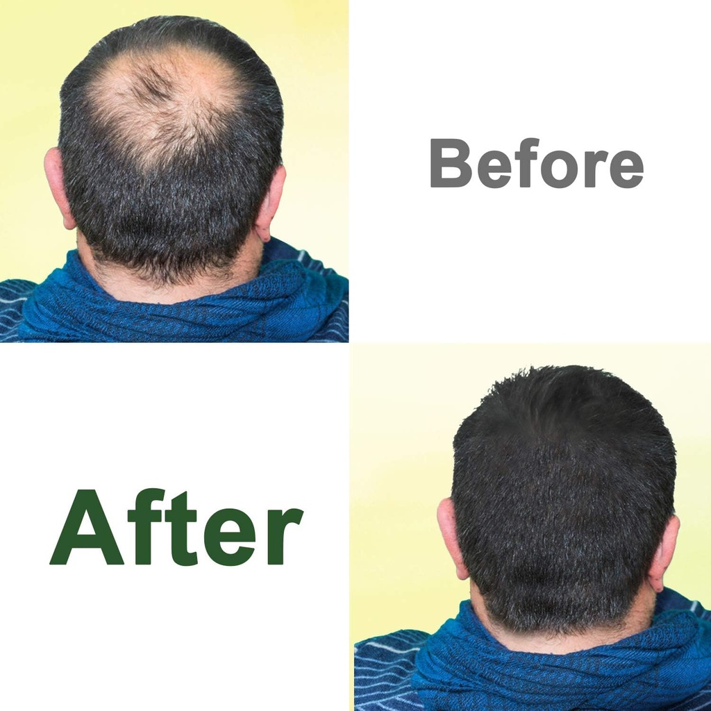 castor-oil-organic-and-pure-cold-pressed-4.jpg