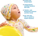 eczema-cradle-cap-rash-itch-relief-for-m-2.jpg