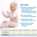 eczema-cradle-cap-rash-itch-relief-for-m-4.jpg