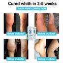 arthroheal-hyaluronic-acid-joint-r-epair-4.jpg