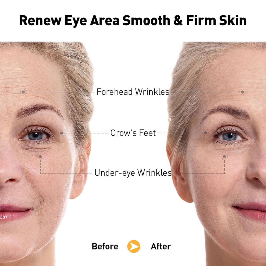 retinol-eye-cream-for-anti-aging-wrinkle-6.jpg
