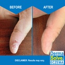 dermasolve-eczema-relief-body-wash-2-pac-4.jpg