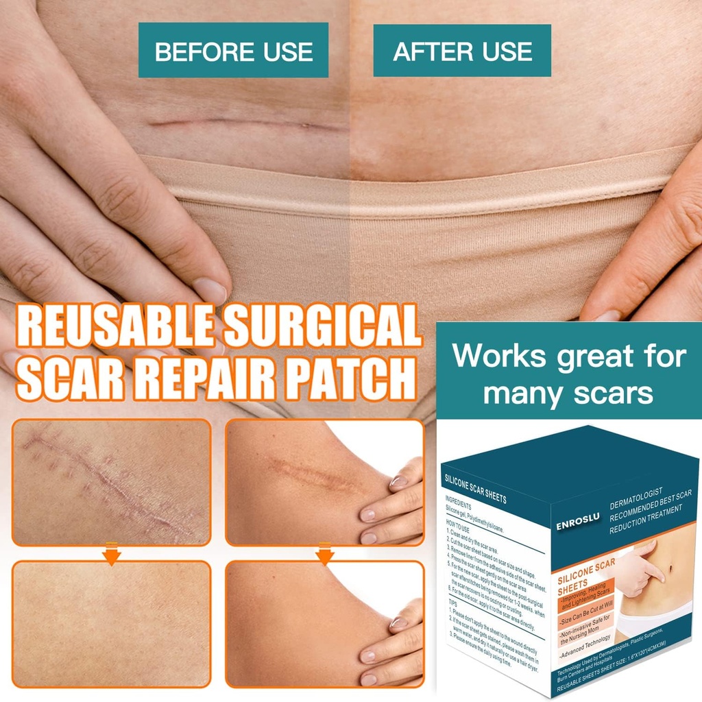 upgrade-silicone-scar-sheets-16-x-120--3-6.jpg