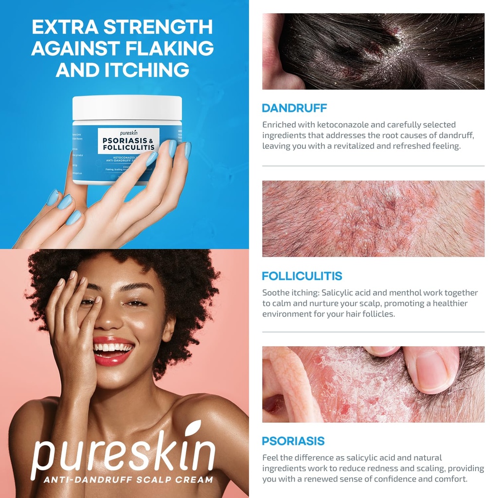 scalp-soothing-cream-for-flaking-skin-te-2.jpg