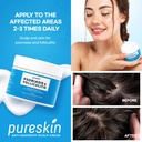 scalp-soothing-cream-for-flaking-skin-te-5.jpg