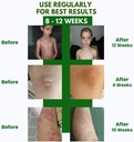 psodex-psoriasis-cream-34fl-oz-topical-p-3.jpg