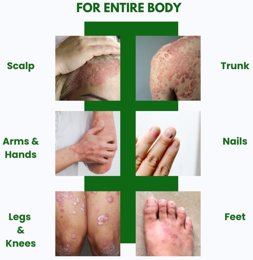 psodex-psoriasis-cream-34fl-oz-topical-p-4.jpg