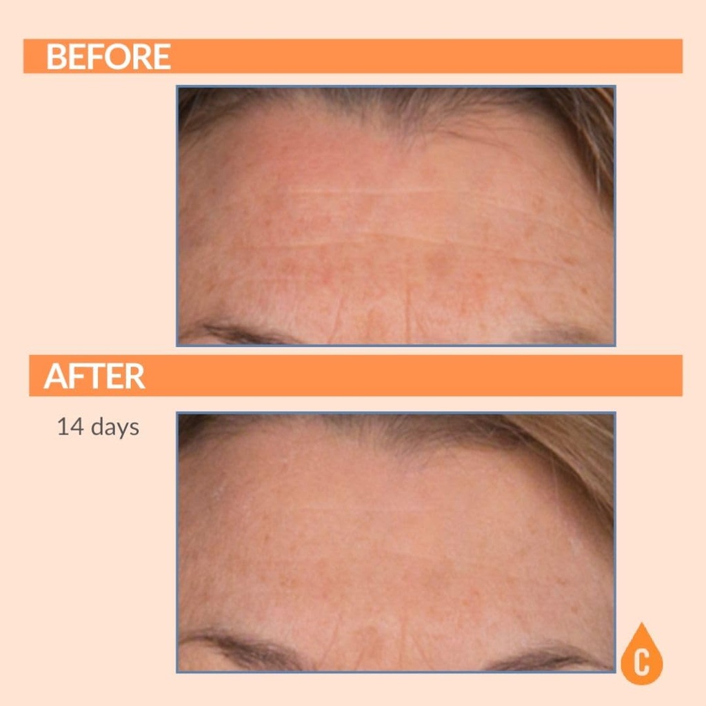 serious-skincare---vitamin-c-ester-pads--5.jpg