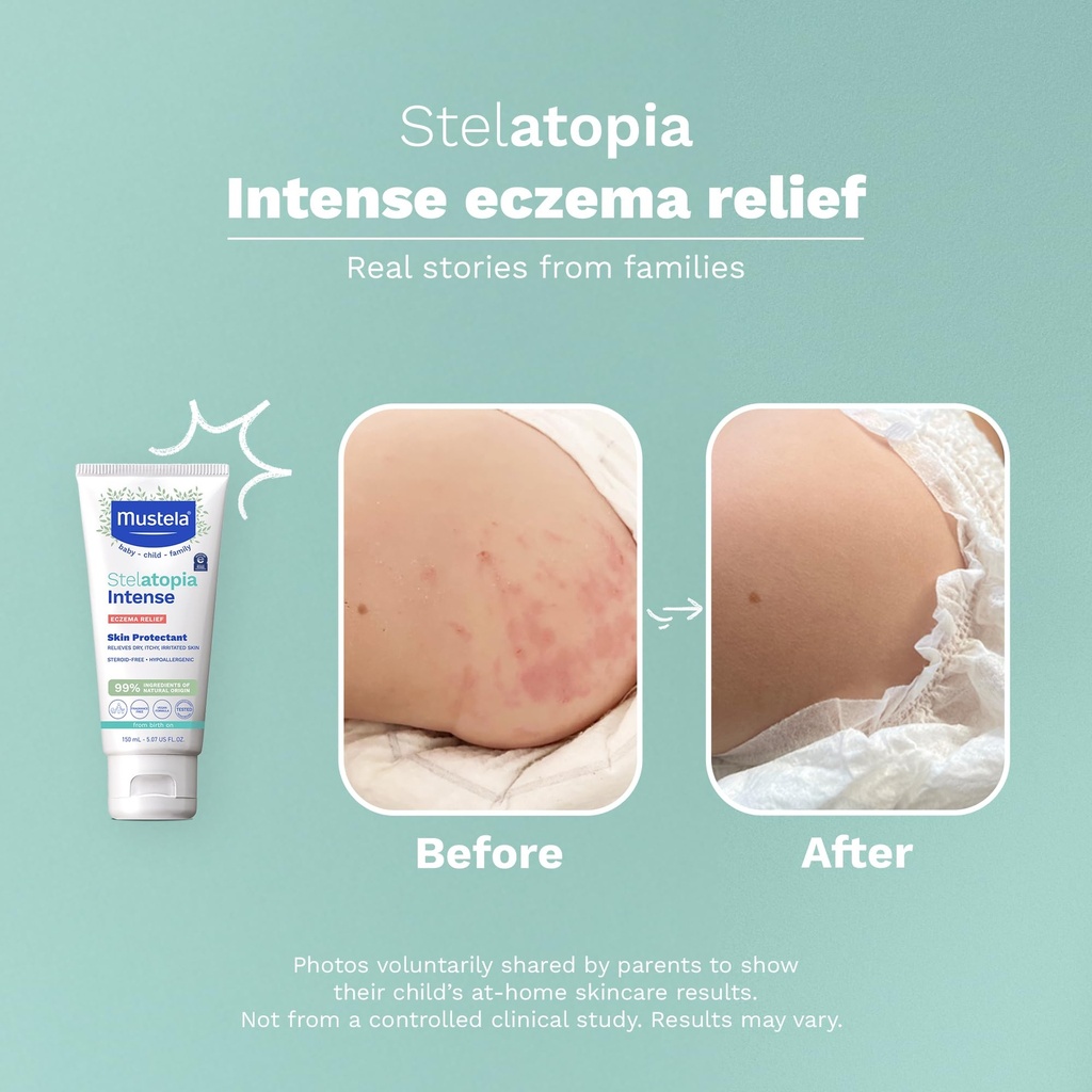 mustela-eczema-relief-cream-stelatopia-i-5.jpg