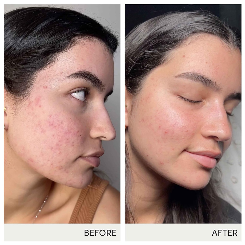 jane-iredale-skin-accumax-nutritional-su-5.jpg