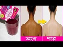 2box-gluta-berry-200000-mg-drink-punch-s-2.jpg